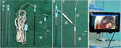 Contact neuro-endoscopy-assisted cerebral hematoma evacuation under direct vision